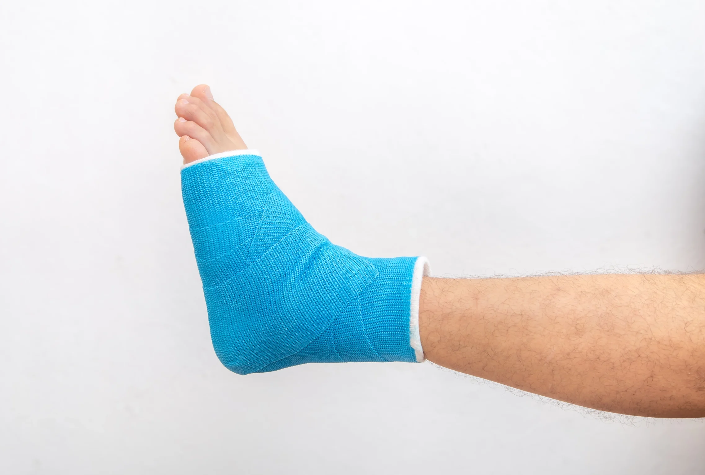 Remboursement de la fibre de verre – Le plâtre de fibre synthétique gratuit et accessible à tous